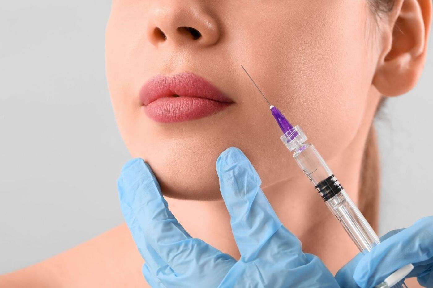 Fillerbehandling ved Cosmetica Klinikken